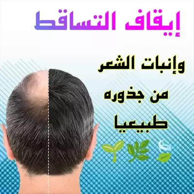  صورة 1 علاج تساقط الشعر