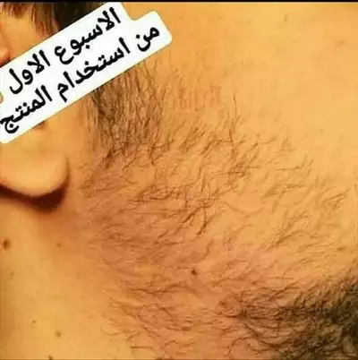  صورة 7 فوائد الزيت الطبيعي المثالي