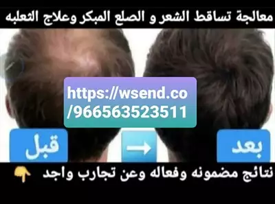  صورة 2 زيت الشعر الأفغاني الأصلي مصرح من هيئة الغذاء