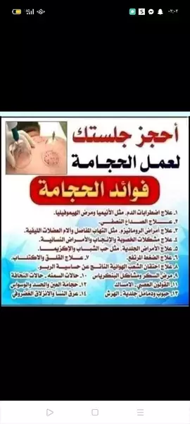 صورة - حجامه منزليه بمكه يوجد خصم ٪50