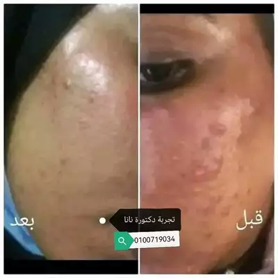  صورة 10 Dr Nana cosmetics للتراكيب الآمنة تفتيح