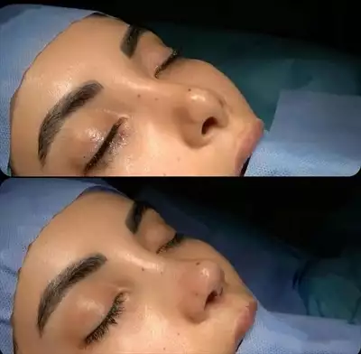  صورة 3 تجميل و العلاج في ايران