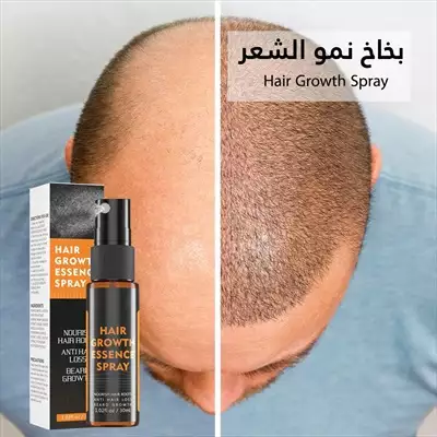  صورة 10 بخاخ نمو الشعر Hair Growth Spray