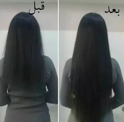  صورة 3 زيت بروكسي الافغاني لحل جميع مشاكل الشعر